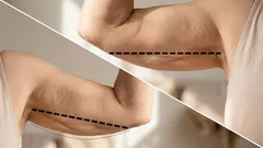 Flabby Arms? 3 Simple Exercises from a Fitness Trainer